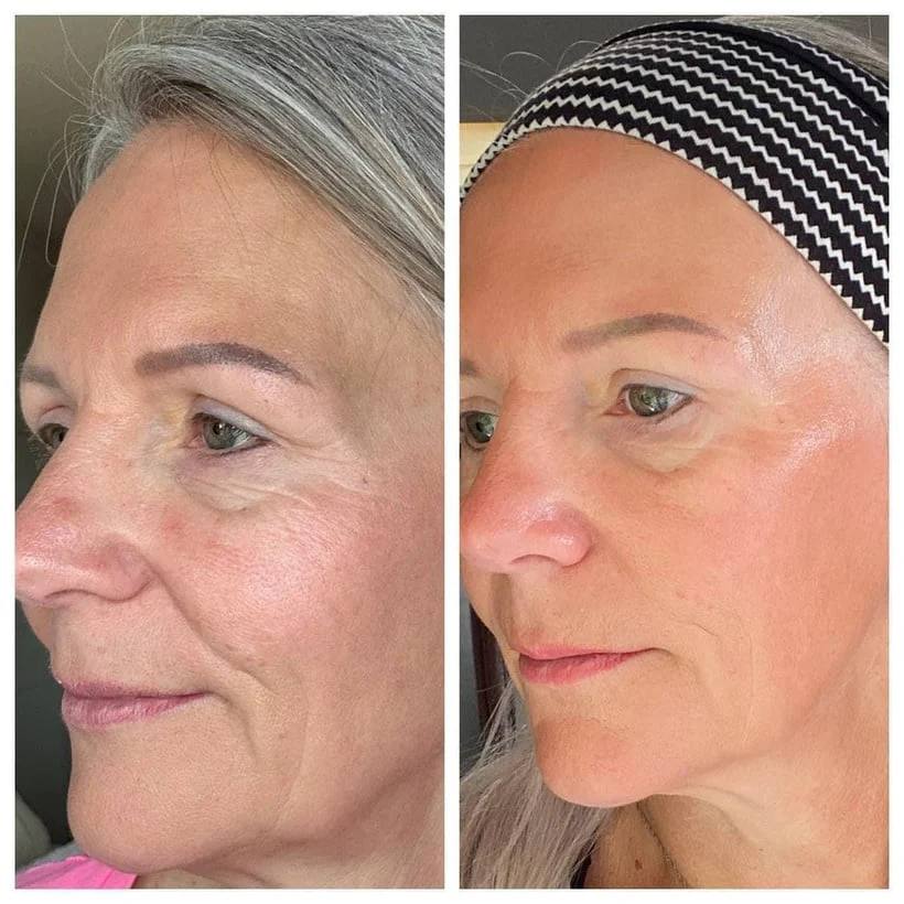 GlamiLift™ — Sculpt & Depuff Your Face